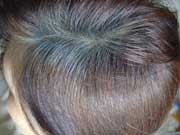 Dieses Bild zeigt diesselbe Stelle nach der darauffolgenden Färbung mit Indigo. Durch die fehlende Hennafärbung hat das Haar nur einen blassblauen Schimmer.